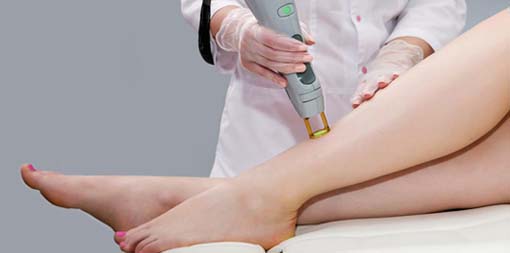 Laser hair removal service